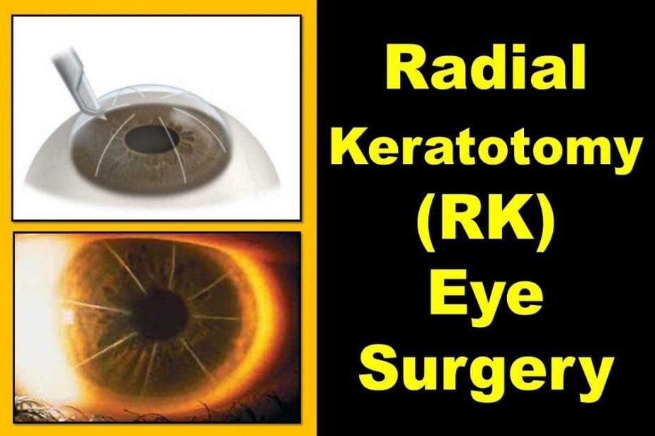 Macula Lutea Of The Eye Anatomy Function Problems Health Kura