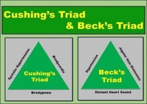 triad becks beck