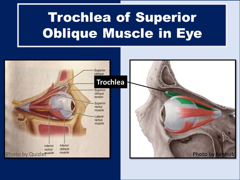 superior-oblique-muscle-in-eye-orbit