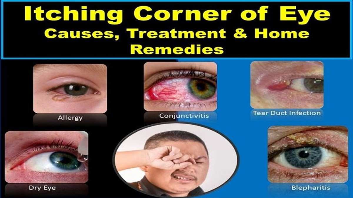 how-do-you-stop-eyes-from-itching-at-ambrose-house-blog