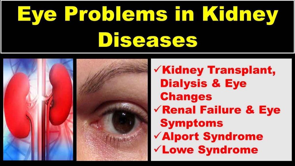 eye-in-kidney-diseases-failure-transplant-dialysis