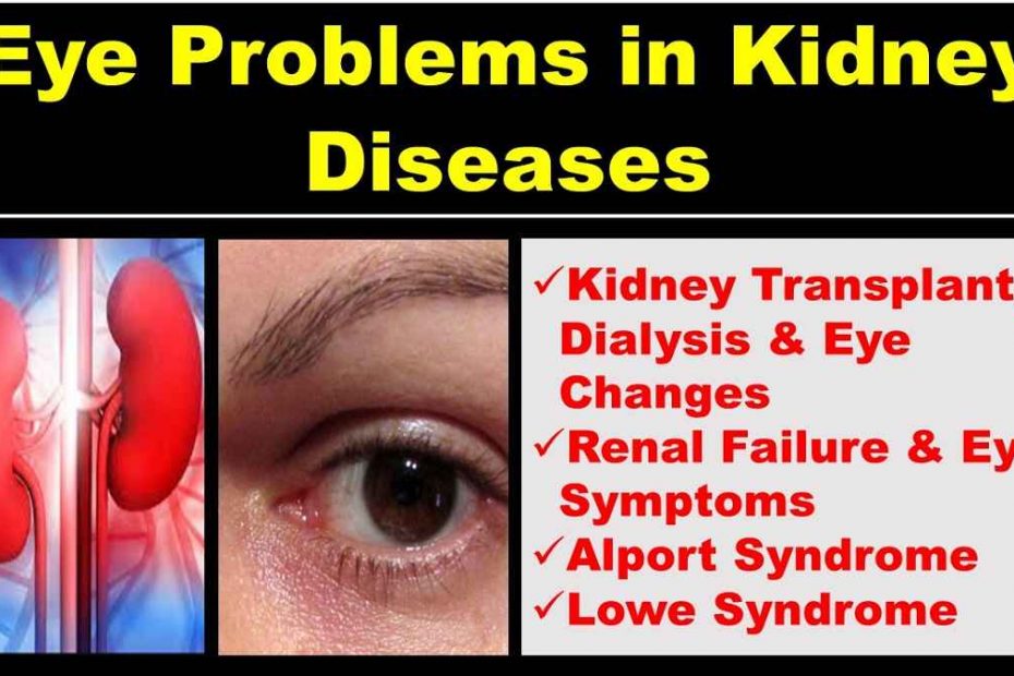 eye-in-kidney-disease-failure-transplant-dialysis