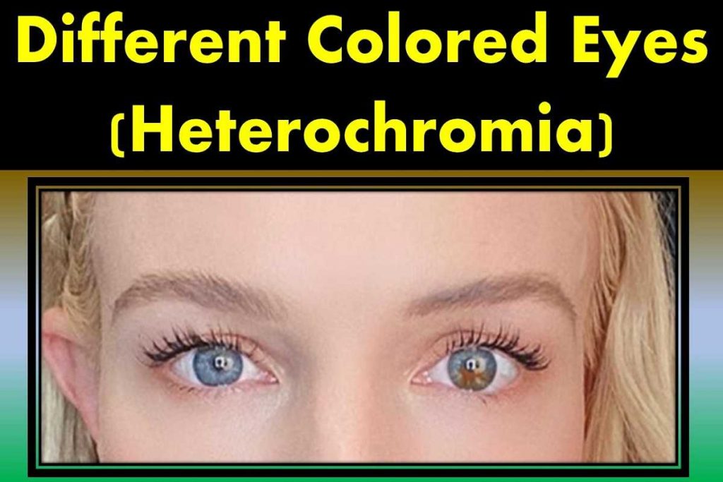 multi-two-different-colored-eyes-heterochromia
